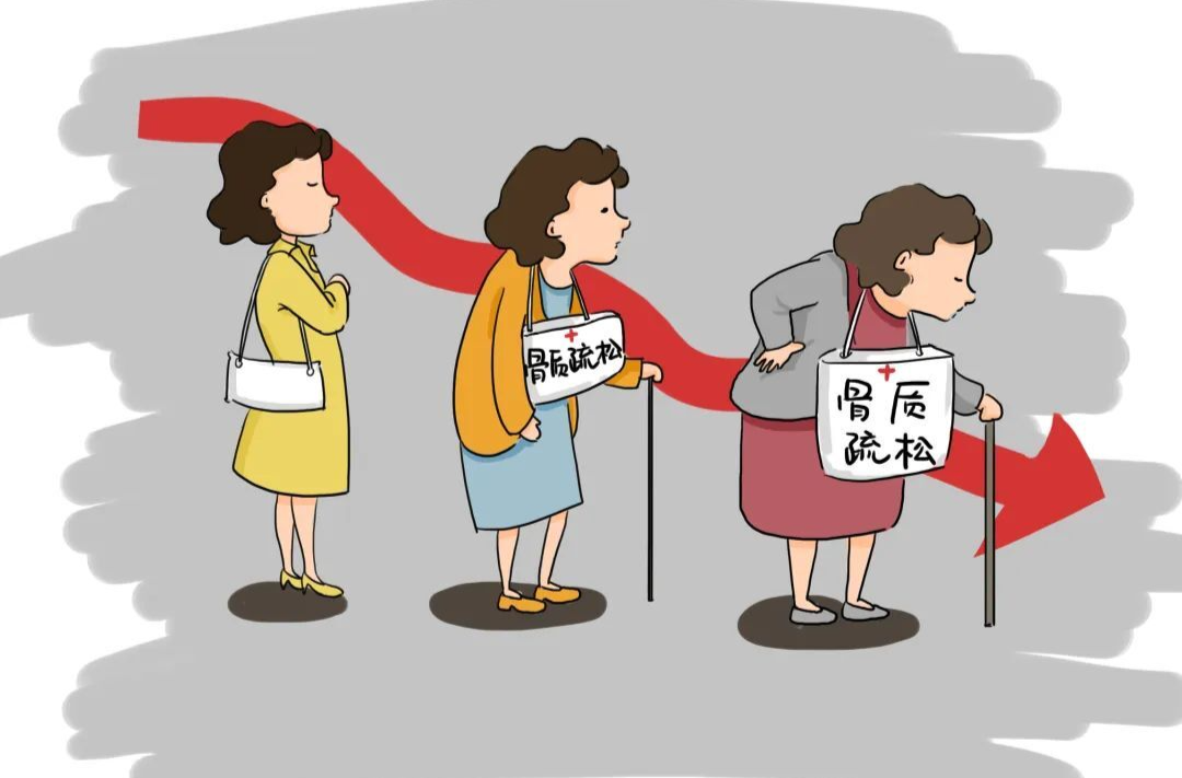 年纪大了就会“弯腰驼背”？当心背后的疾病 | 科普时间