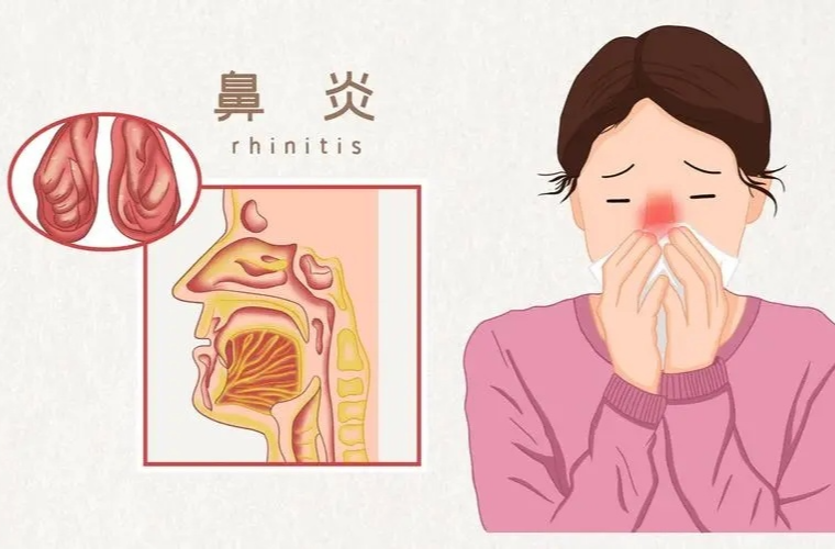 秋季气候干燥，如果出现鼻出血，我们该如何应对？又该如何预防过敏性鼻炎呢？丨时令节气与健康