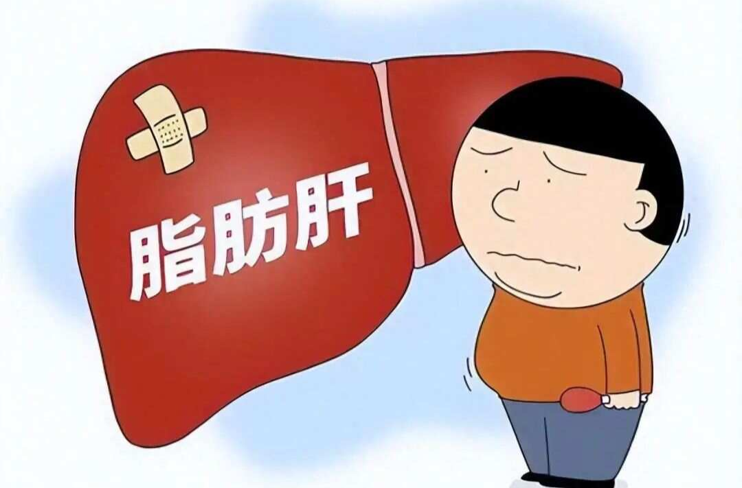 得了脂肪肝，就要吃保肝药……是真是假？｜谣言终结站
