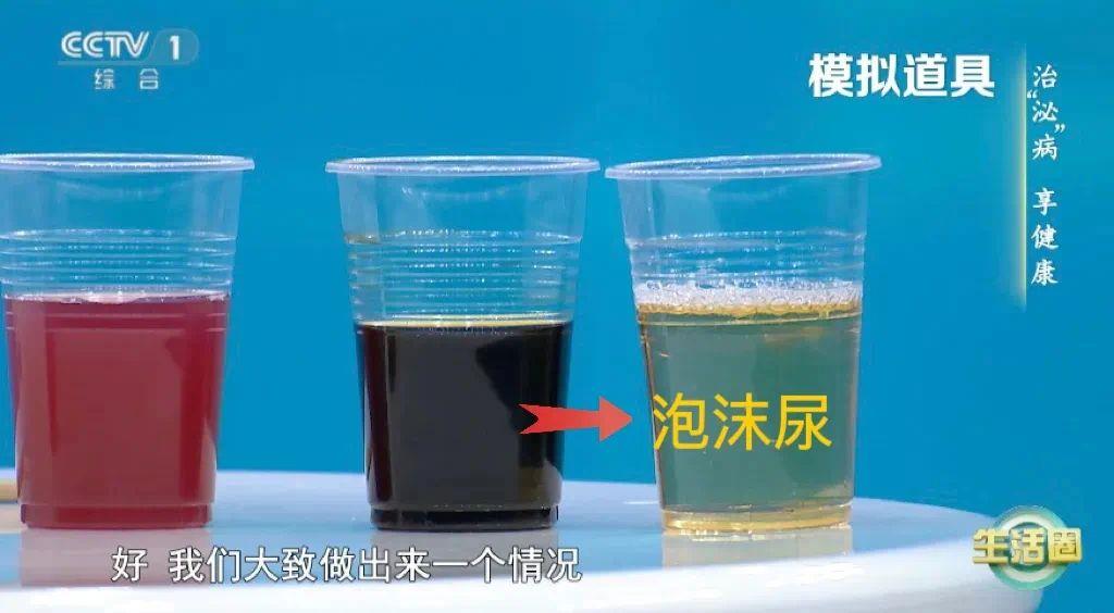 周末·健康丨喝水后4个异常 可能是肾发出的“求救信号”