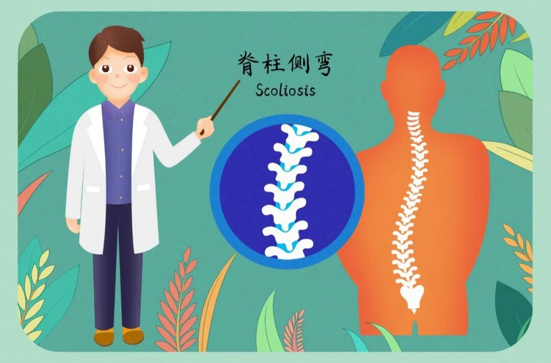 别让脊柱侧弯“偷走”孩子挺拔的身姿｜科普时间