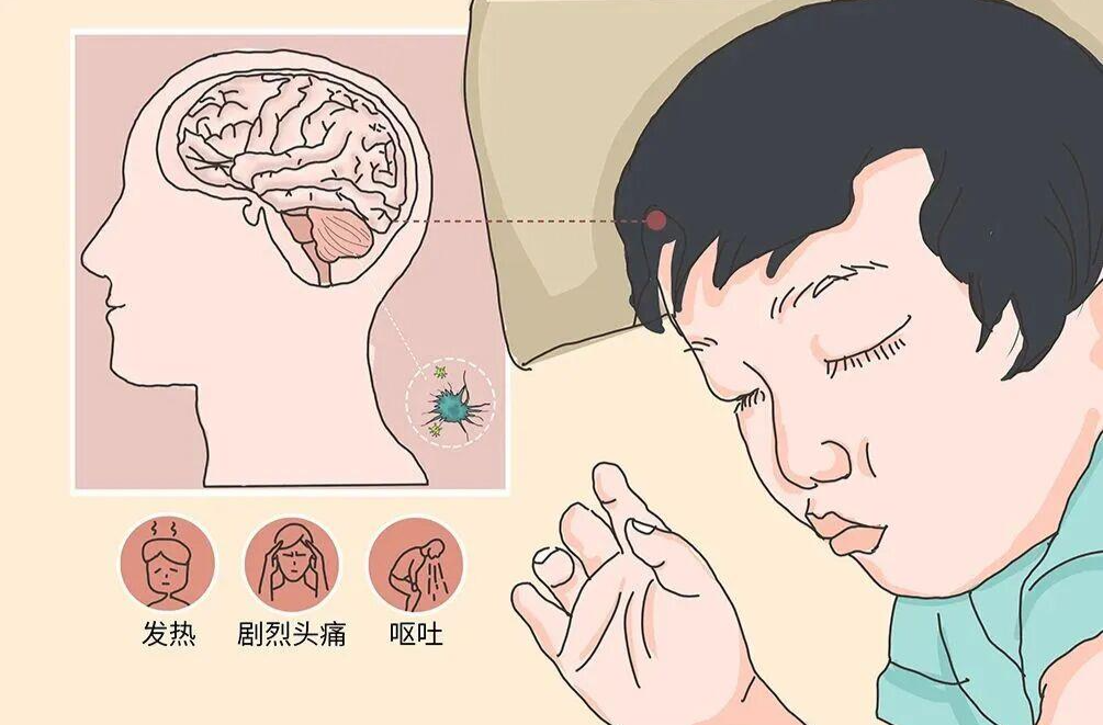周末·健康丨性情大变、出现幻觉，警惕得了这种病