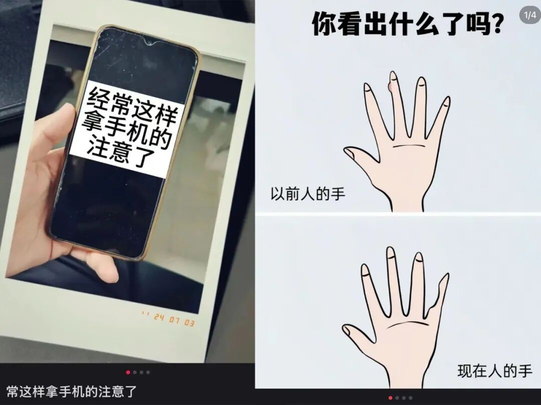 周末·提醒丨第一批用小拇指做“手机支架”的受害者出现了？医生提醒